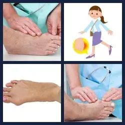 4 Pics 1 Word BUNION